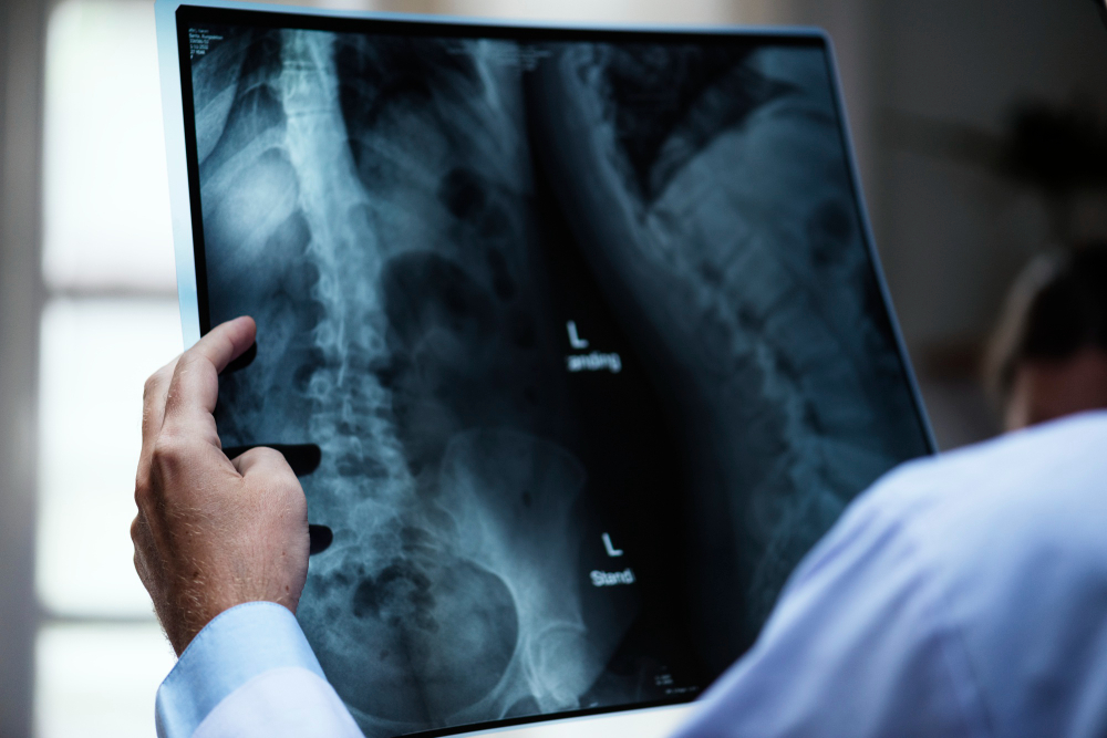 X-Rays in Roswell